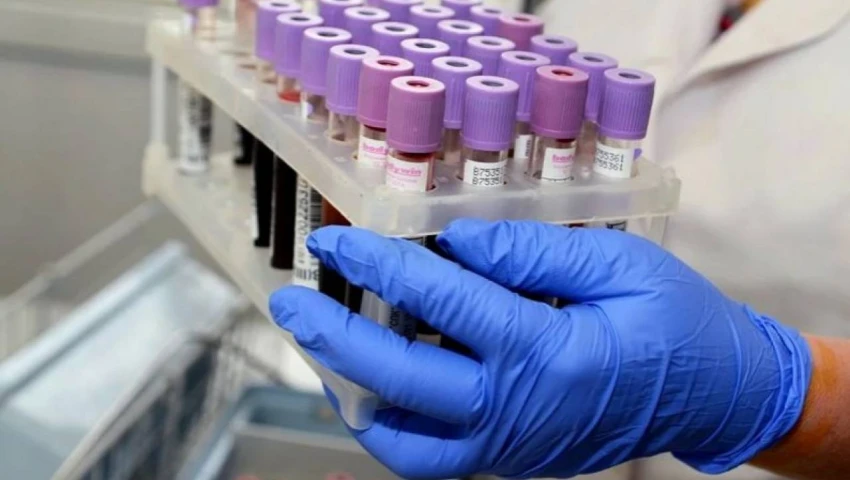 Новый анализ крови способен выявить 18 видов рака на самых ранних стадиях