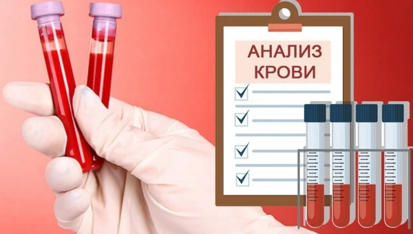 Journal of Cancer: Первый в мире анализ крови на рак мозга может повысить выживаемость