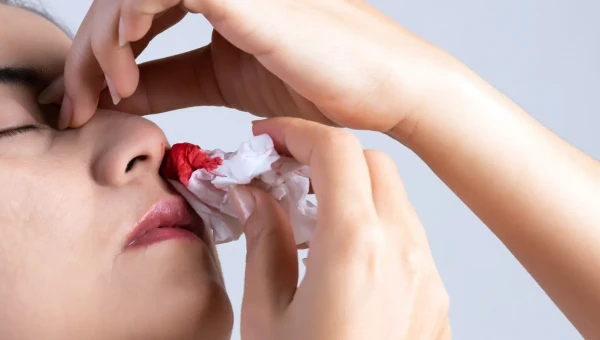 Врач Кондрахин назвал продукты, способные предотвратить течение крови из носа