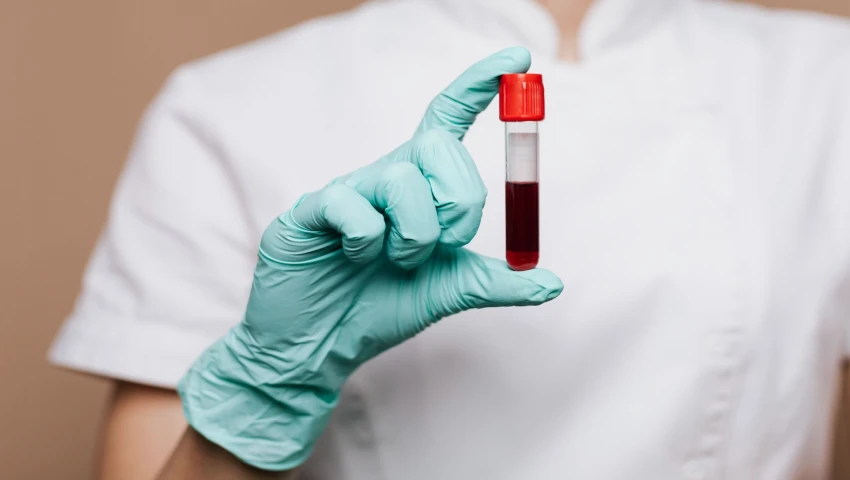 AJRCCM: В США создали простой анализ крови для быстрой диагностики саркоидоза
