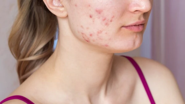 Косметолог Громкая назвала продукты для поддержания здоровой кожи лица