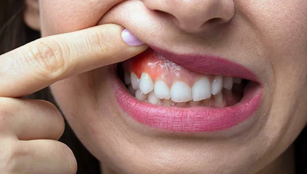 JAD: Проблемы с зубами снижают самооценку и увеличивают риск смерти