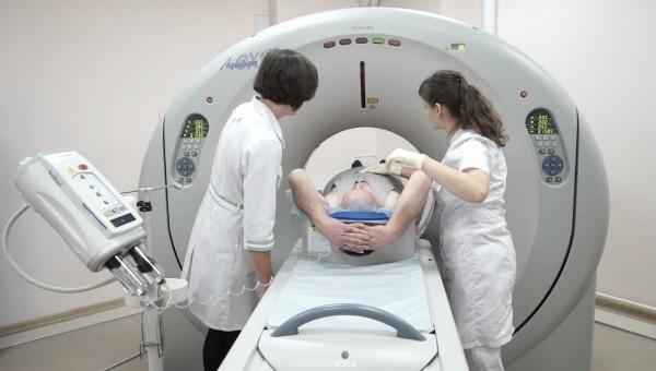 Radiology: Вероятность инсульта можно узнать по уровню кальция в артериях