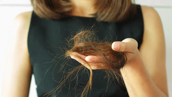 Врач Соломатина заявила, что остановить выпадение волос можно масками из лука
