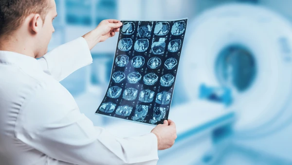 Nature Medicine: ИИ может ухудшить работу рентгенологов