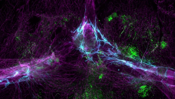 NatCom: Иммунные клетки признаны ключевыми игроками в здоровье мозга