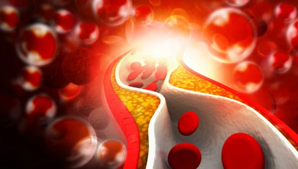 Discover BMB: Постельный режим влияет на уровень холестерина