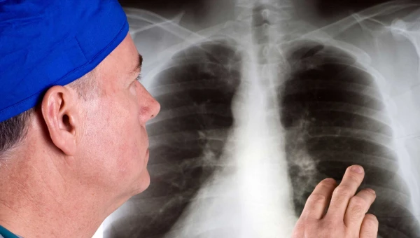 Развитие заболеваний лёгких связано с респираторными болезнями у курильщиков