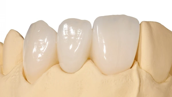 Стоматолог Калинин: Старые коронки могут быть опасны для зубов