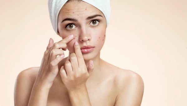 Dermatology: Трифаротен в сочетании с уходом за кожей полезен при акне