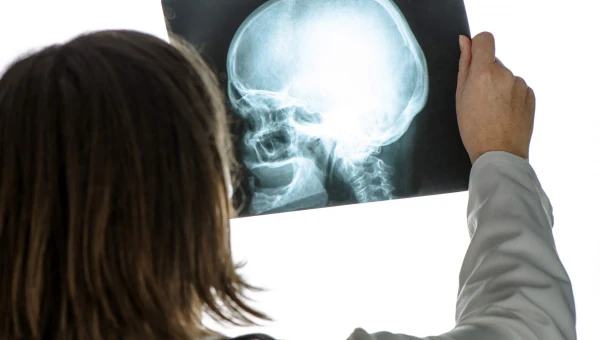 ANC: Опухоли мозга могут быть связаны с травмой головы