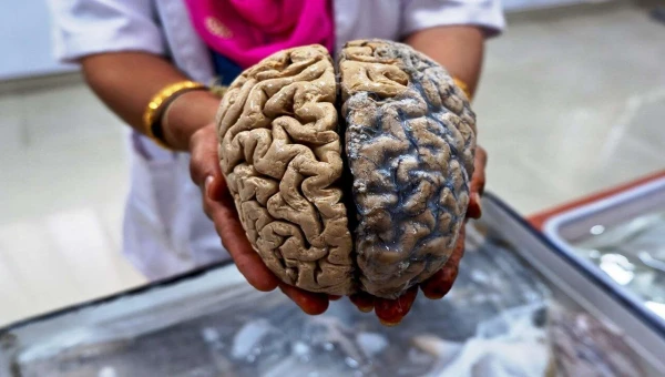 JNeurosci: Ясный ум долгожителям обеспечивает белое вещество головного мозга