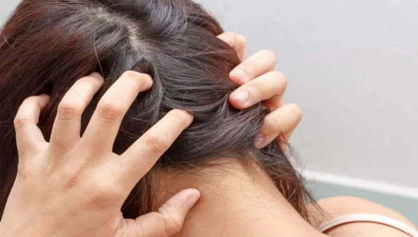Daily Mail: Диетолог Брюер зуд кожи головы связан с недостатком витаминов А и В