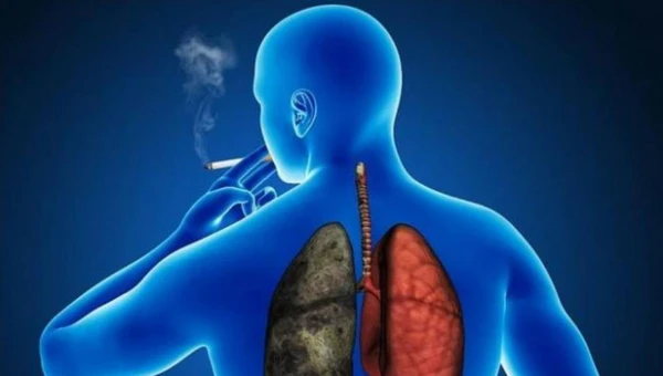 Раскрыт путь лечения рака лёгких у никогда не курящих пациентов