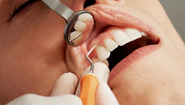 Dentistry: Потеря зубов может привести к повышенной застенчивости и депрессии