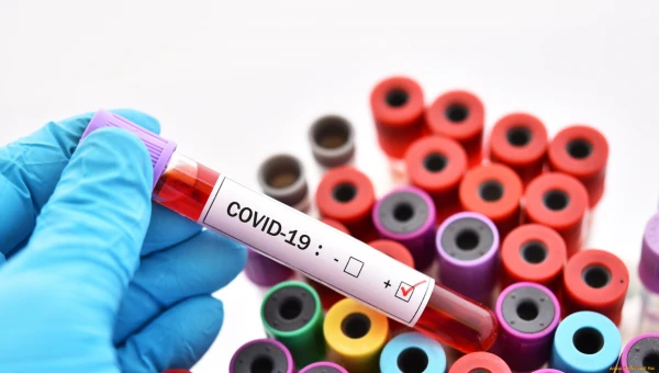 Паксловид безопасен, но не даёт преимуществ при длительном лечении COVID-19
