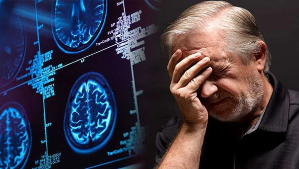В России анонсировали нейросеть для ранней диагностики Альцгеймера