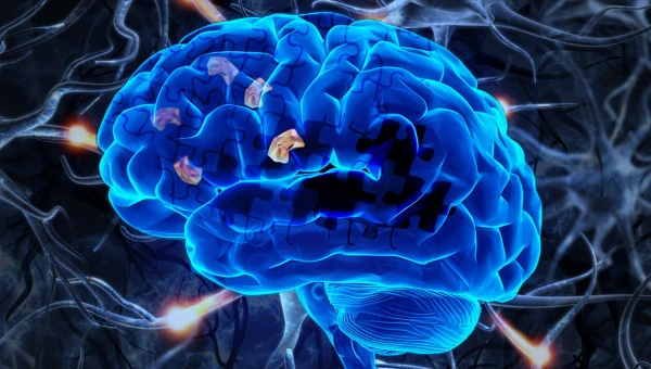 Редкий генетический вариант защищает мозг от болезни Альцгеймера