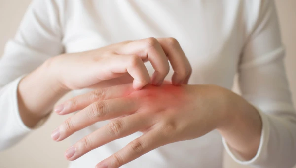 Редкие кожные болезни можно облегчить с помощью пересадки здоровой кожи