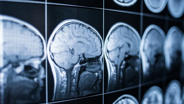 Когнитивный тест не позволяет предсказать сотрясение мозга у спортсмена